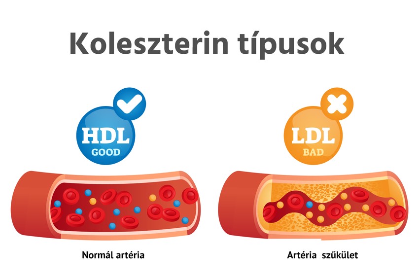 Koleszterin típusok