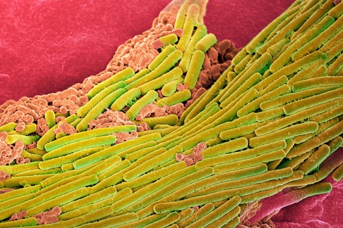 Clostridioides difficile