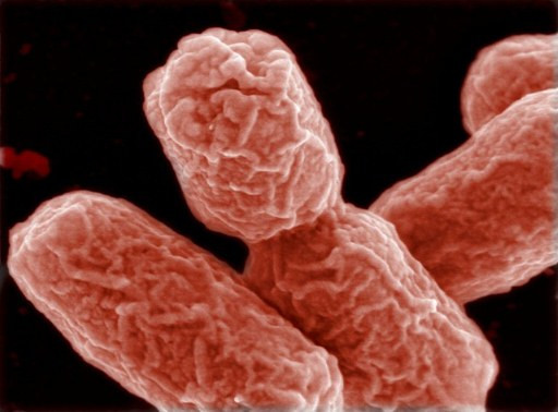 Bakteria E.coli