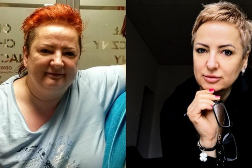 Edyta w ciągu dwóch lat schudła 50 kg, chociaż do nowej wagi musiała się długo przyzwyczajać. 