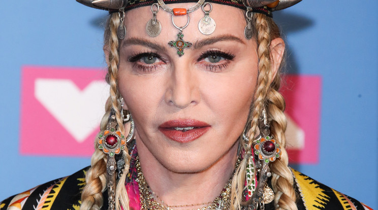 Madonna már teljesen jólvan, kész színpadra állni azután, hogy június végén kórházba került/ Fotó: Northfoto