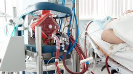 ECMO