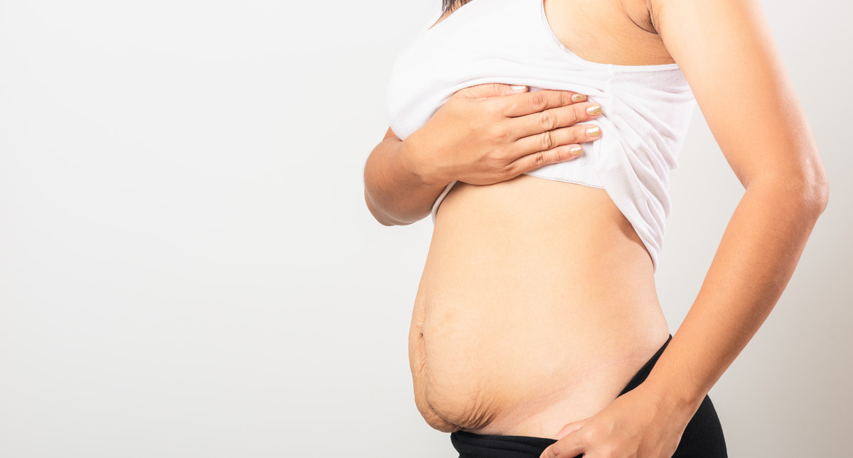 Brzuch po porodzie - pielęgnacja, dieta, ćwiczenia