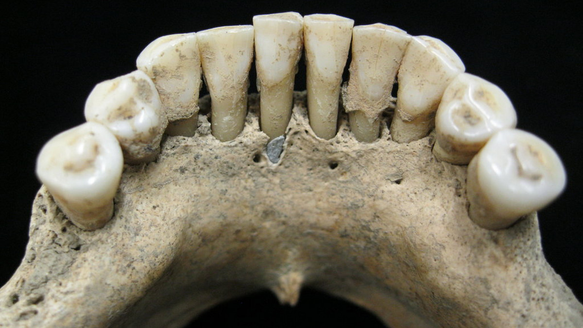 Naukowcy pracujący na jednym z cmentarzy w Niemczech odkryli średniowieczny grób kobiety, na której uzębieniu znajdowało się niebieskie ubarwienie.