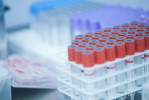 Badania krwi pracownika – kiedy są obowiązkowe i od czego zależy ich zakres