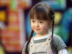 Sensacja naukowa! Geny walczą z zespołem Downa