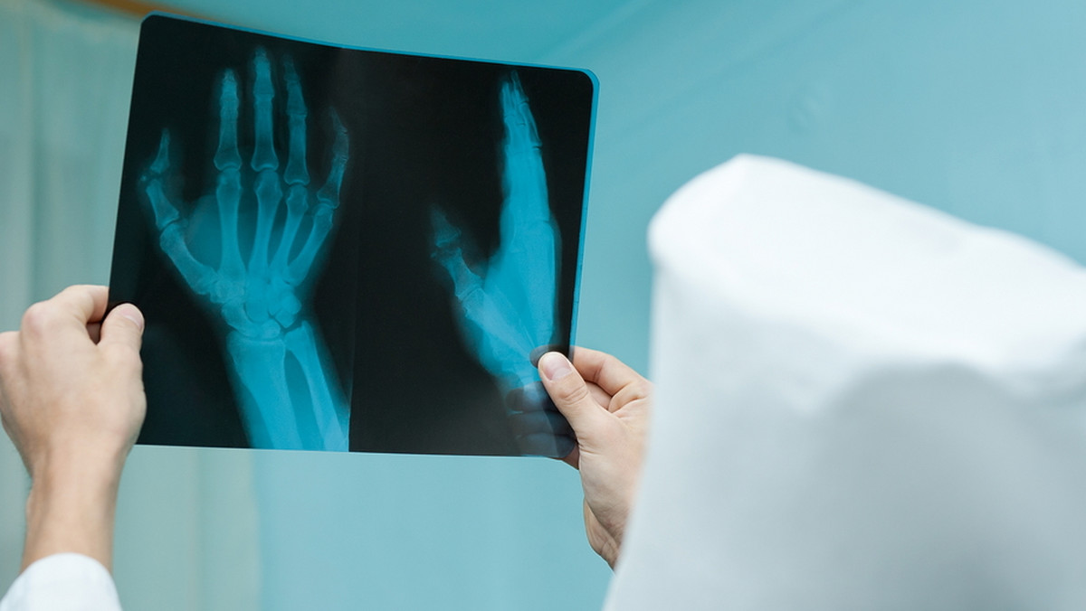 Kontrola w krakowskiej klinice ortopedii po skargach pacjentów