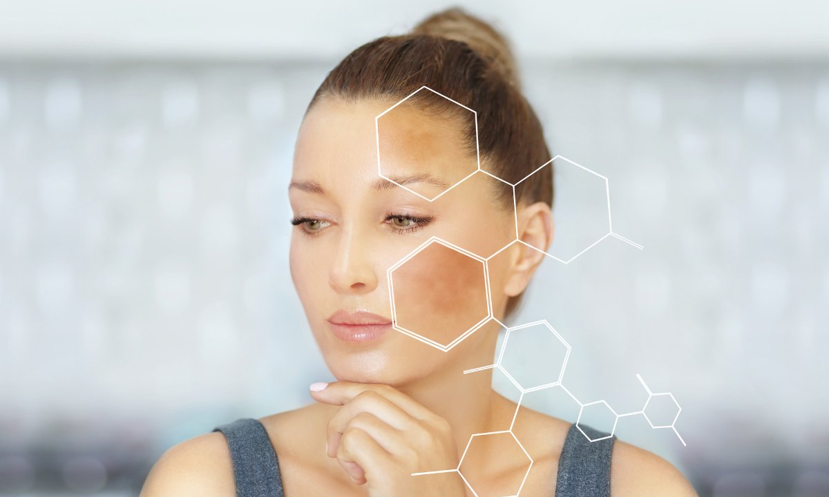 Ten krem usuwa z twarzy niedoskonałości jak gumka! Znikają przebarwienia i plamki starcze