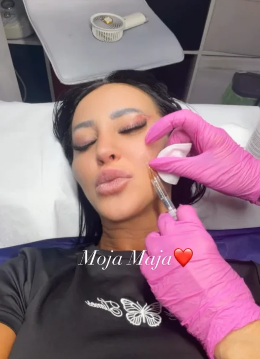 Slađa Poršelina uradila novi zahvat nakon što je imala tri operacije odjednom