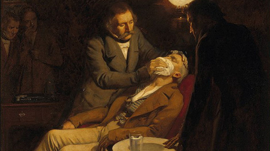 Usypianie pacjenta przed ekstrakcją przez Williama Mortona