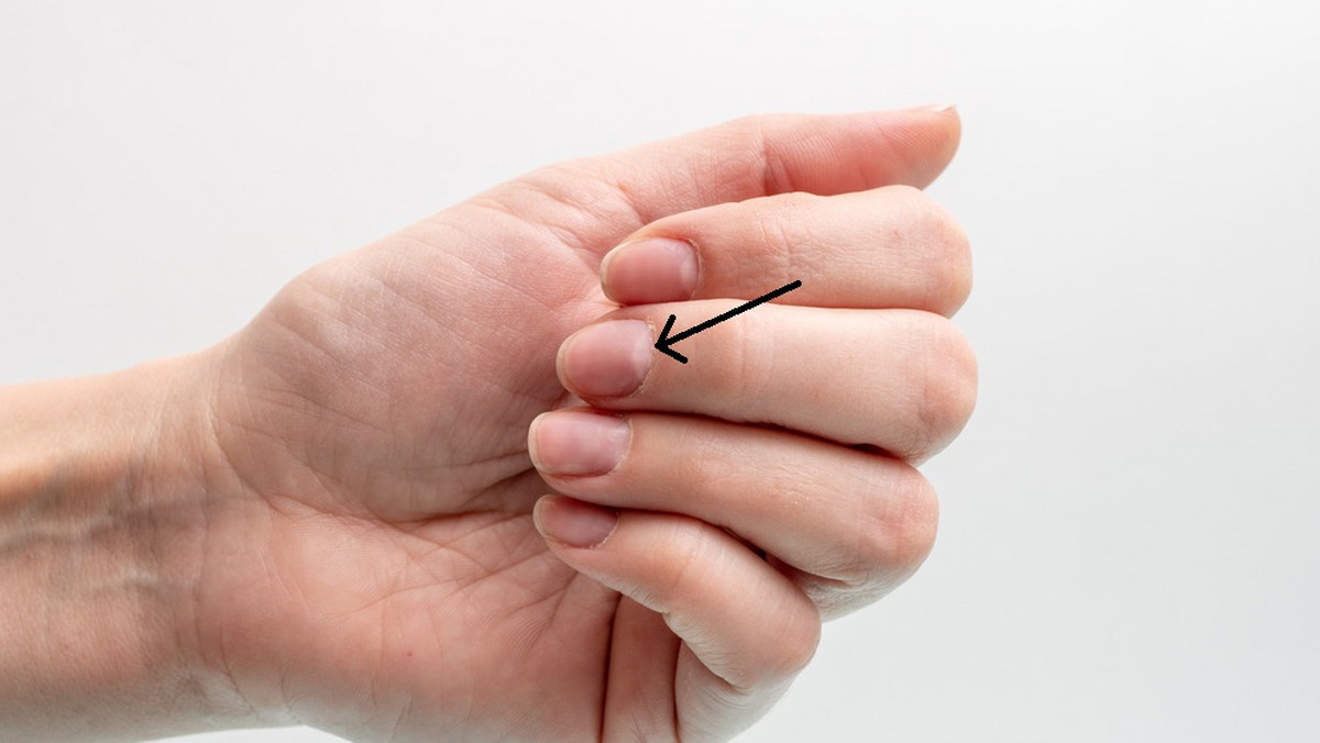 Lunula lub obłączek - biała część paznokcia