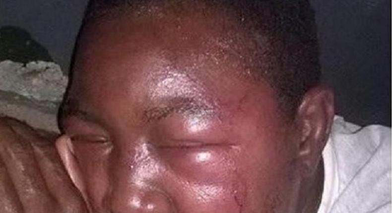 Olalowo Hakeem was not expected to survive this beating by his kinsmen