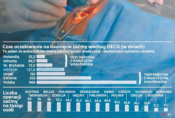 Czas oczekiwania na usunięcie zaćmy według OECD