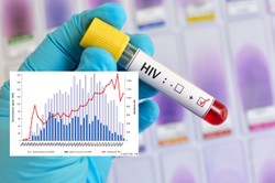 Wielka Brytania chwali się spadkiem zakażeń HIV. A w Polsce bijemy kolejne rekordy