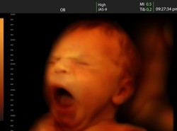 Ziewanie rozwija mózg. Zobacz płód w akcji