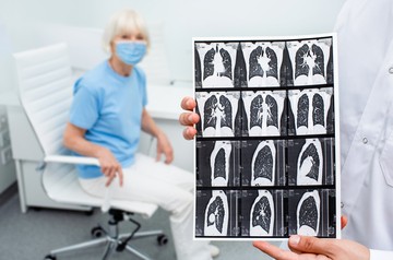 Tüdőfibrózis: szeptember a ritka tüdőbetegségek hónapja