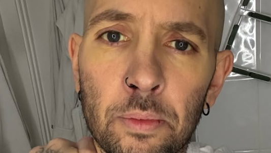 Spevák prehral boj s rakovinou.