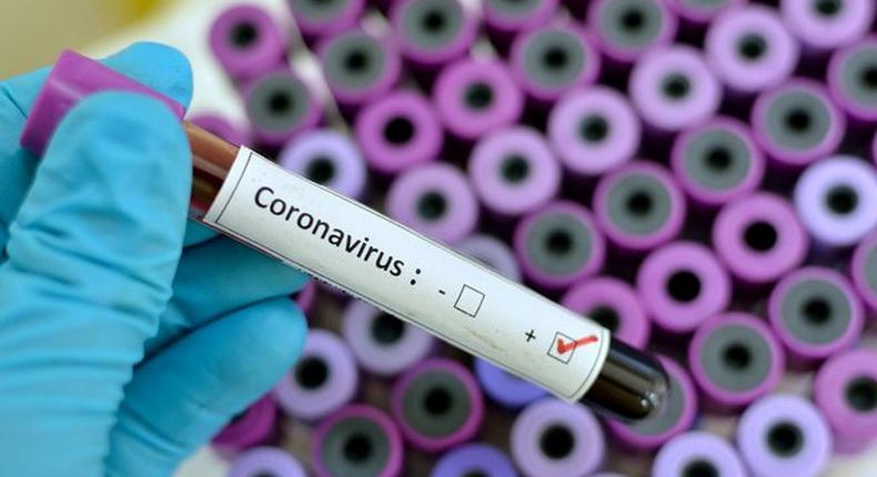 Ghana has now recorded 636 Coronavirus cases