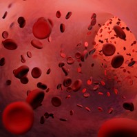Stroke-előjelek: ilyen érzés, amikor agyvérzést kap az ember