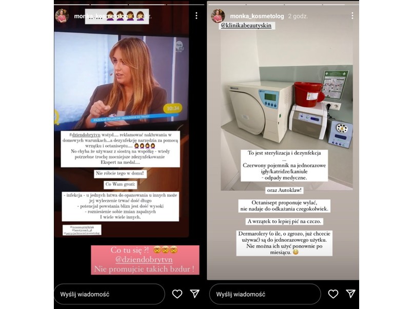 Widok InstaStories użytkowniczki monka_kosmetolog