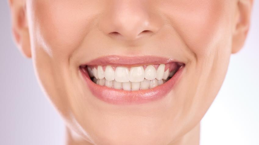 mesterséges intelligencia mosoly száj fogorvos