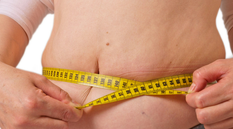 Egy kutatás szerint könnyebben betegszenek meg az elhízottak / Fotó: Northfoto