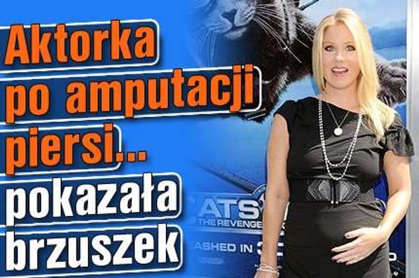 Aktorka po amputacji piersi... pokazała brzuszek