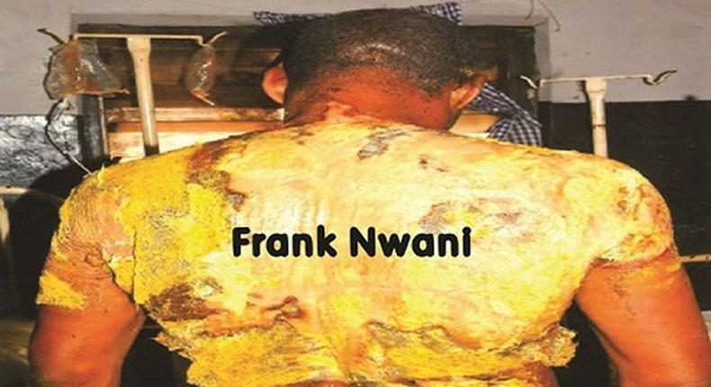 The victim Frank Nwani