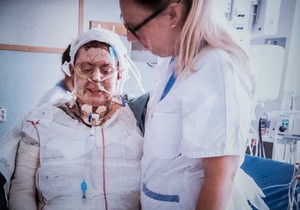 Ema je iz stravičnog požara spasila šestoro dece, evo kako izgleda posle 20 operacija