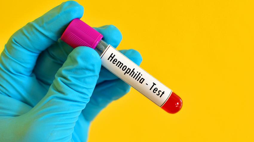 hemofília, vérzékenység, világnap