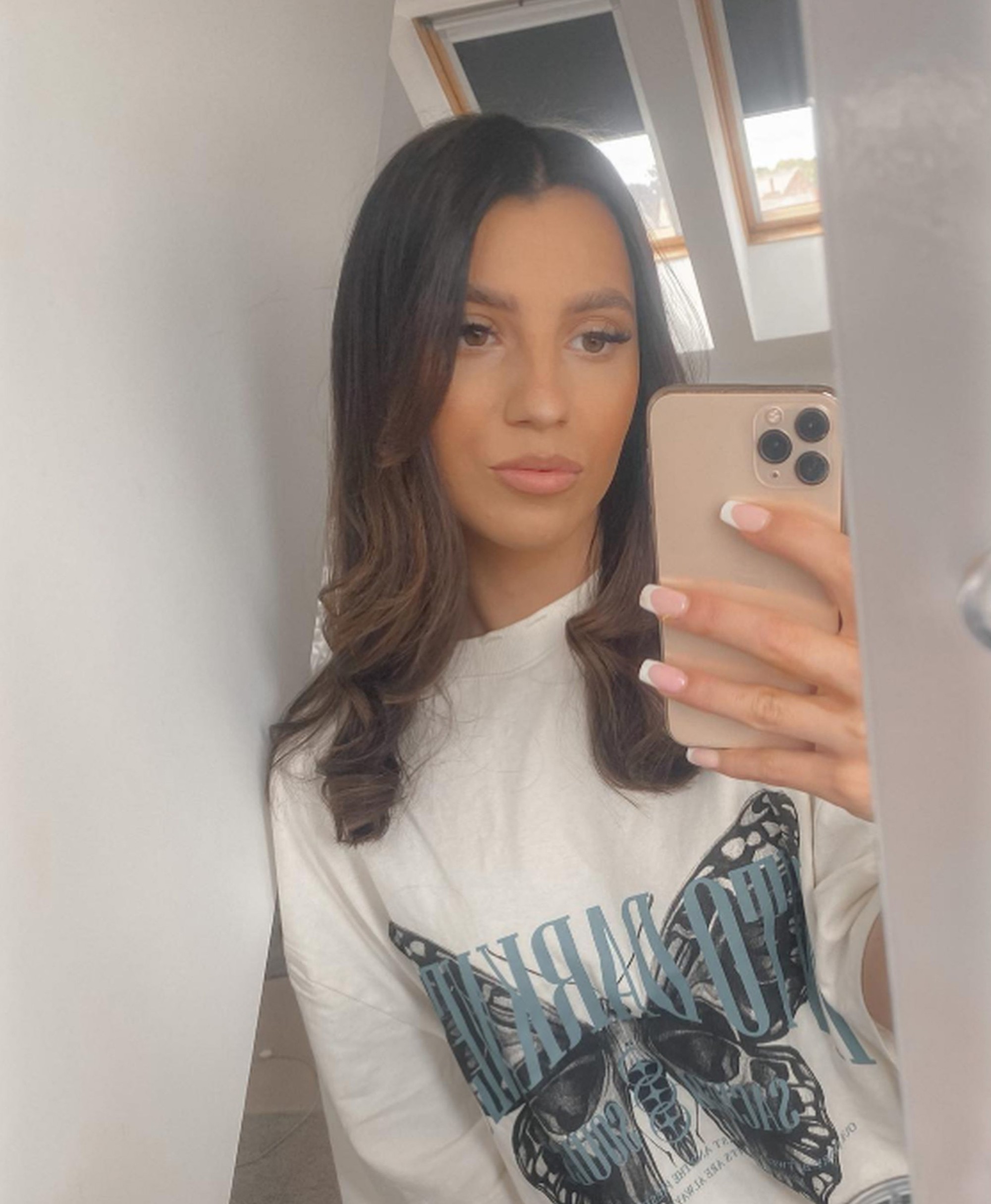 Georgina musela podstúpiť mastektómiu, aby sa rakoviny zbavila.