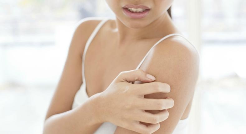 Ringworm: 5 home remedies for this skin infection