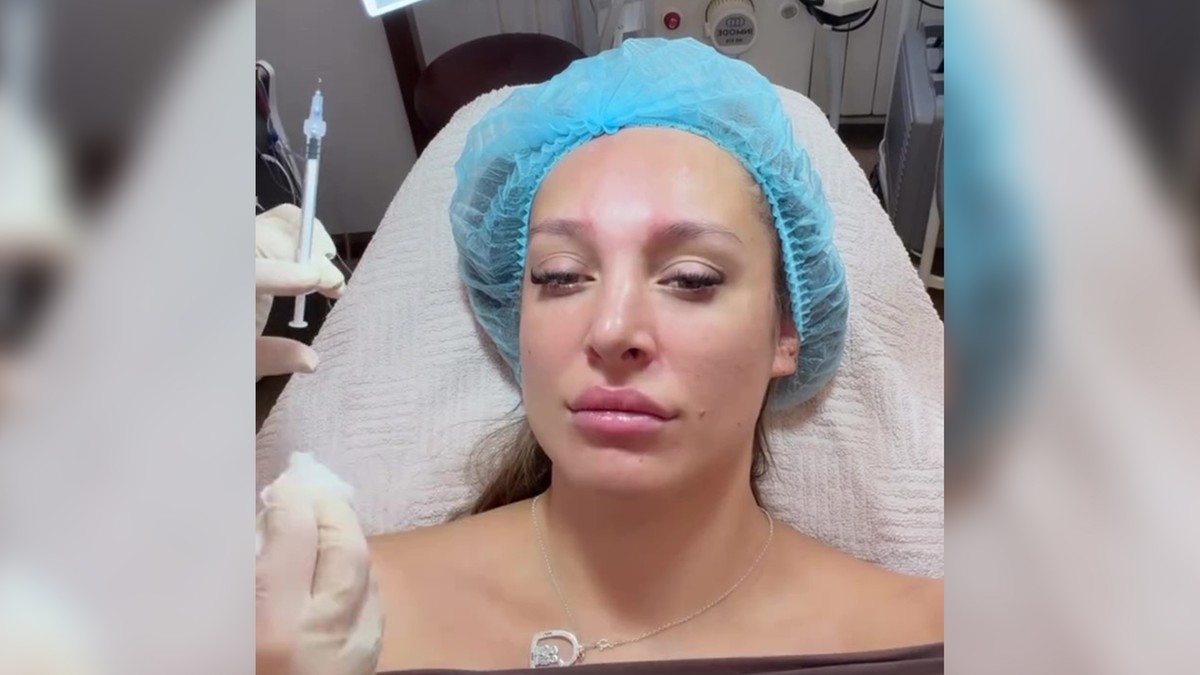 LUNA ĐOGANI NAPUNILA 30 GODINA PA OTIŠLA NA BOTOKS Otkrila da uklanja bore poznatim tretmanom, ovako podmlađuje lice