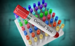 Hormony stresu mogą zwiększać ryzyko nadciśnienia, zawału i udaru