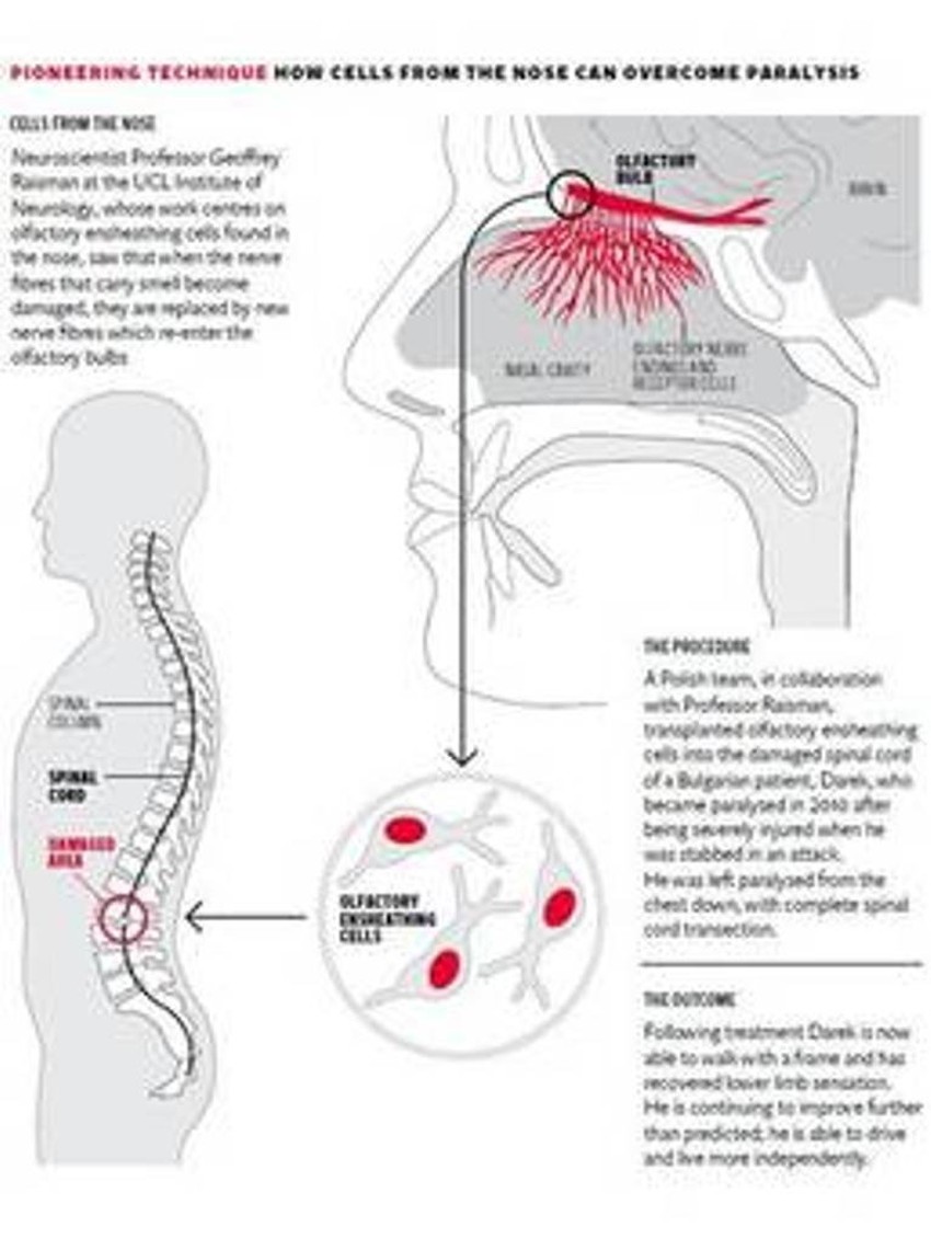 Prikaz cele procedure koja je rezultovala uspešnom operacijom