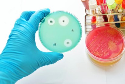 MRSA: már nem csak kórházi fertőzés