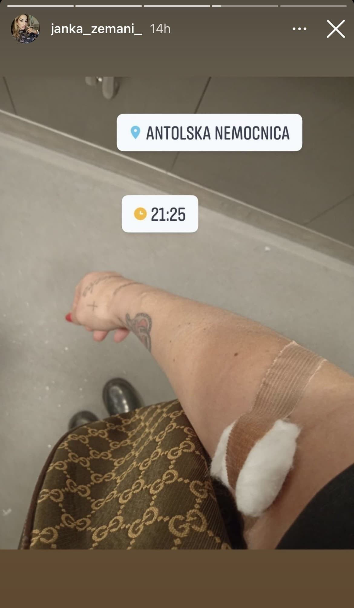 Exfarmárka Jana po krátkom tehotenstve potratila.