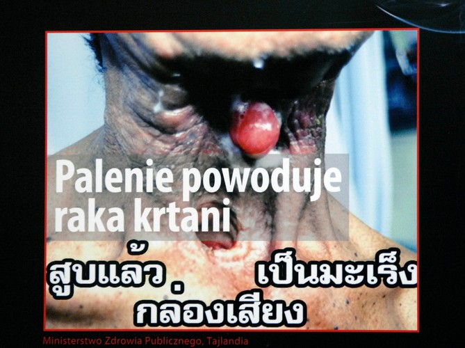 Z okazji Światowego Dnia Bez Tytoniu ministerstwo zdrowia zorganizowało wystawę grafik, jakie w różnych krajach straszą z paczek papierosów