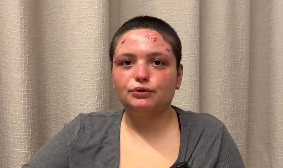 Žrtva požara u Kran-Montani