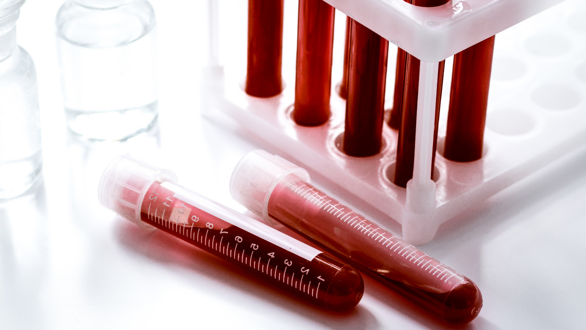 Badanie poziomu przeciwciał <strong>anty HCV</strong> wykonywane jest w celu diagnostyki potencjalnego zakażenia wirusem HCV, czyli wirusem żółtaczki typu C. Badanie wykonywane jest na podstawie próbki krwi. U zdrowego człowieka, przeciwciała <strong>anty HCV</strong> nie powinny być obecne w krwi, jednak wynik dodatni badania nie zawsze oznacza zarażenie wirusem.