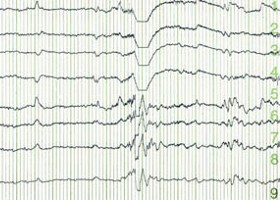 eeg280x200-d000006CF002791e63725