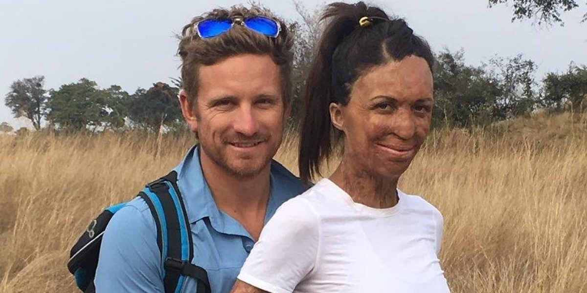 Ciężko poparzona Turia Pitt jest w ciąży z narzeczonym 