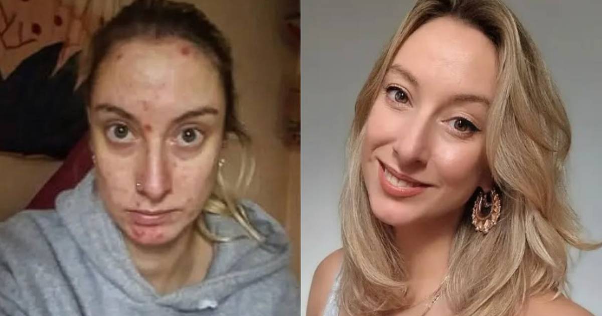 Piła dwie butelki wódki dziennie. W lustrze nie przypominała siebie