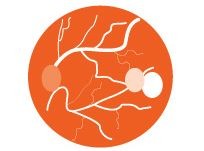 macula-degeneration-280-159px-d00000DF641efc45e3fb8