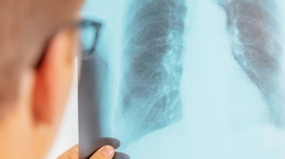 Nowa metoda diagnozowania stopnia zaawansowania raka płuc