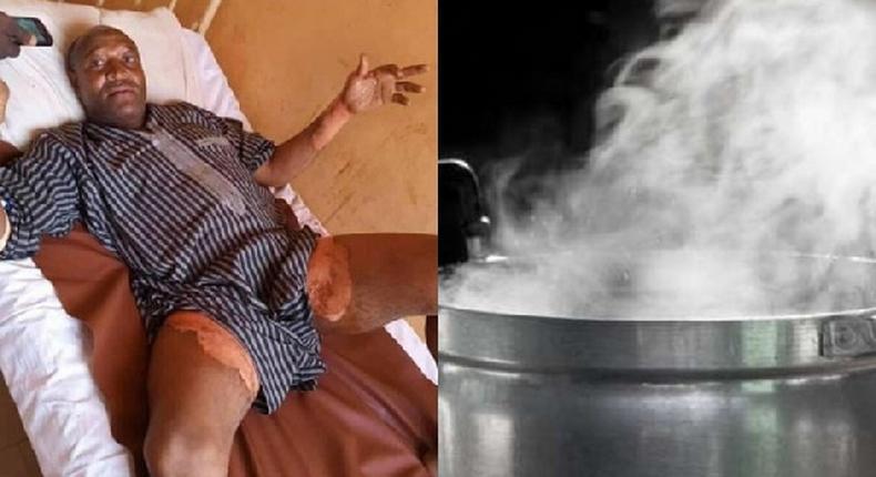 Woman baths husband with hot water