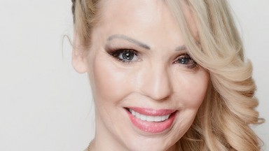 Katie Piper: kiedy spoglądam w lustro, widzę kogoś, kto przetrwał