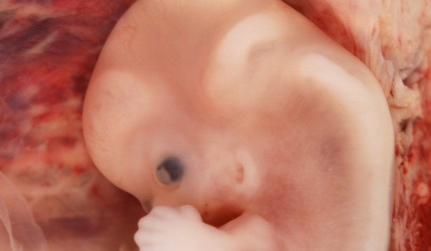 embrion 9 Week Human Ectopic Pregnancy foto Wikipedia