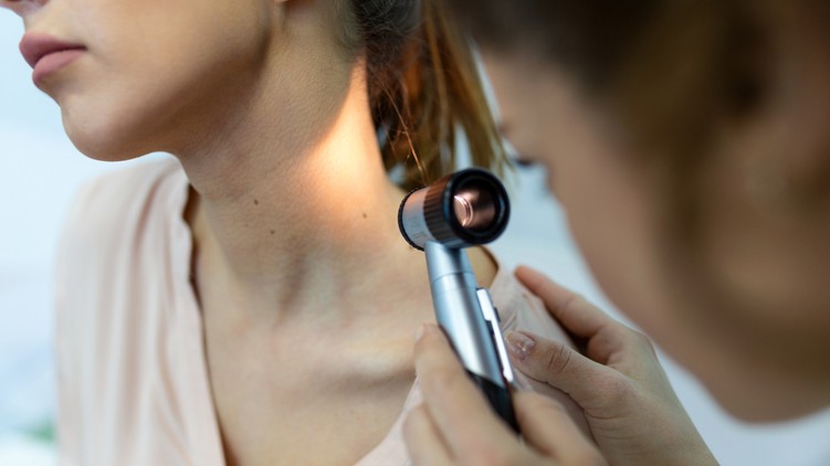 anyajegy elváltozás bőrgyógyász abcd szabály