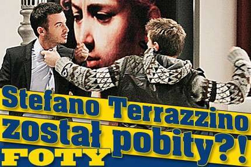 Stefano Terrazzino został pobity?! FOTY